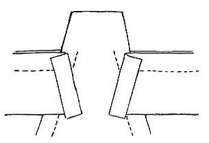Figura 8: colocación de la cintura